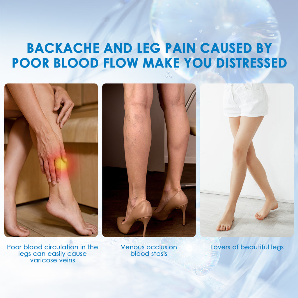 30ml Varicose Vein Spray Multi-Purpose Knee And Leg Care Spray Promote Blood Circulation - photo 2