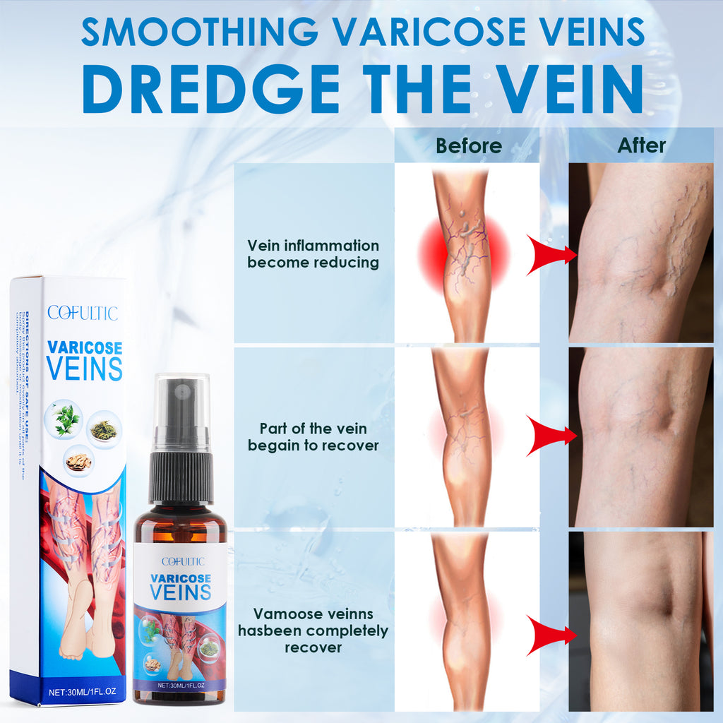 30ml Varicose Vein Spray Multi-Purpose Knee And Leg Care Spray Promote Blood Circulation - photo 5